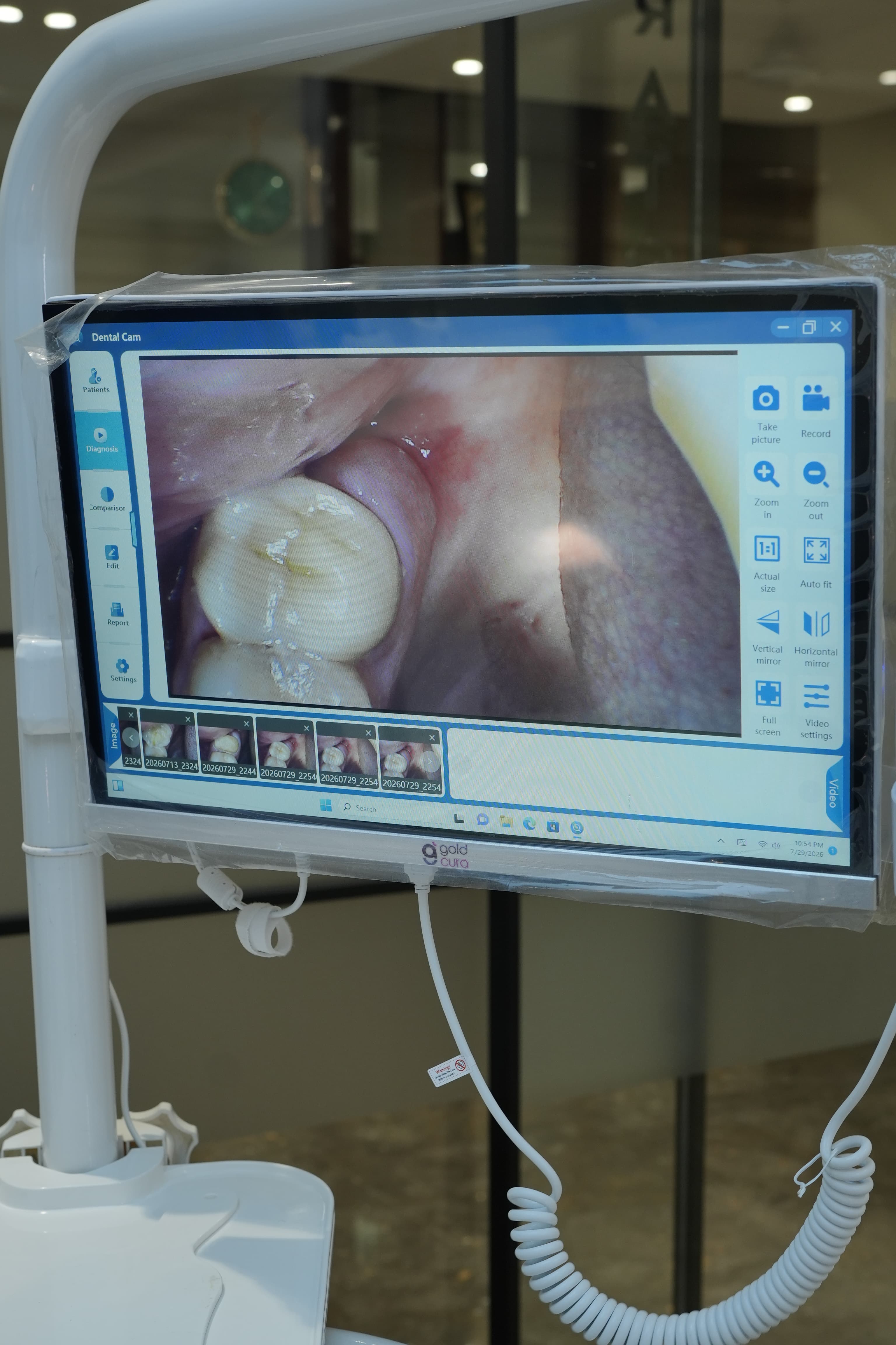 Dental Crowns & Bridges 2