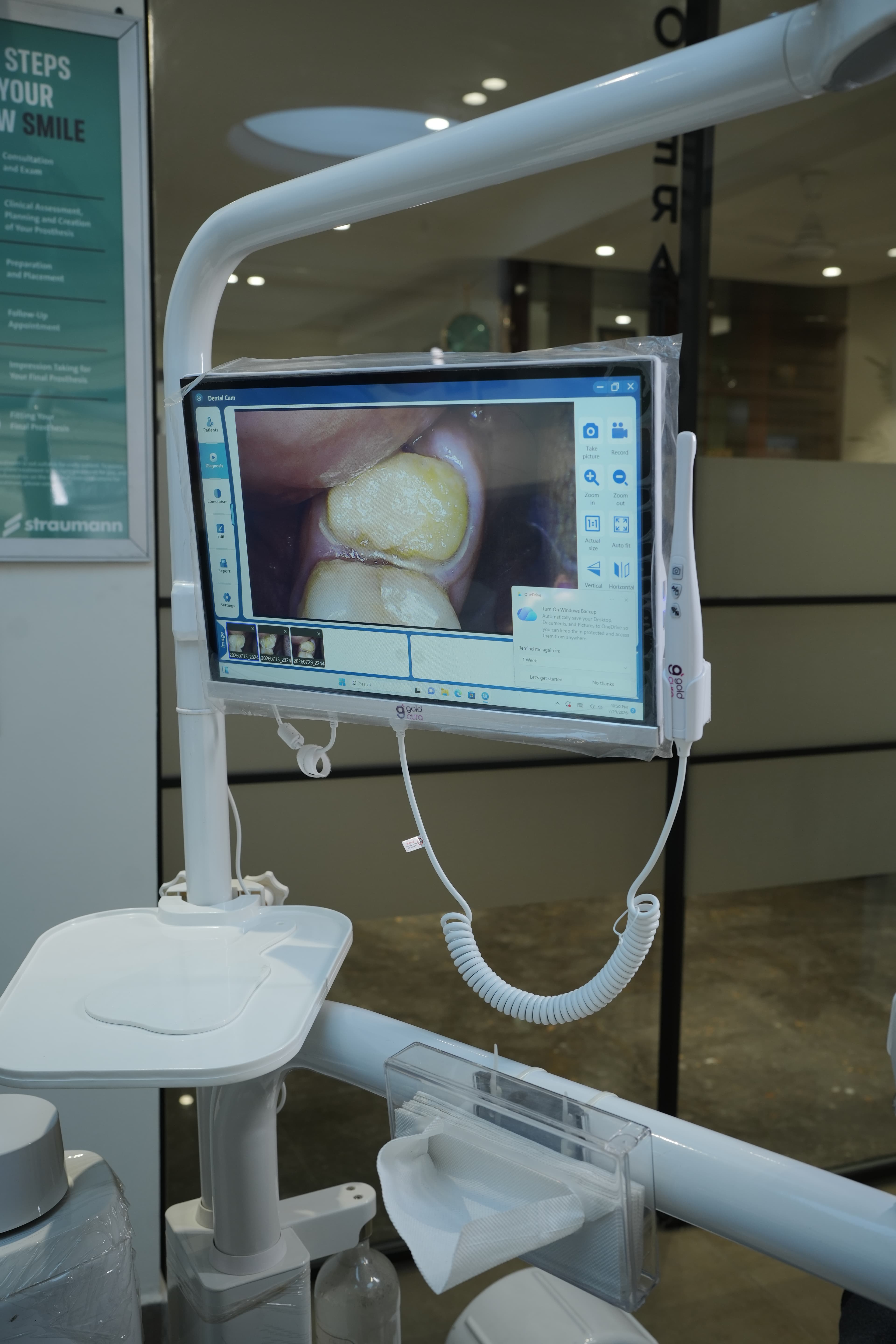Dental Crowns & Bridges 6