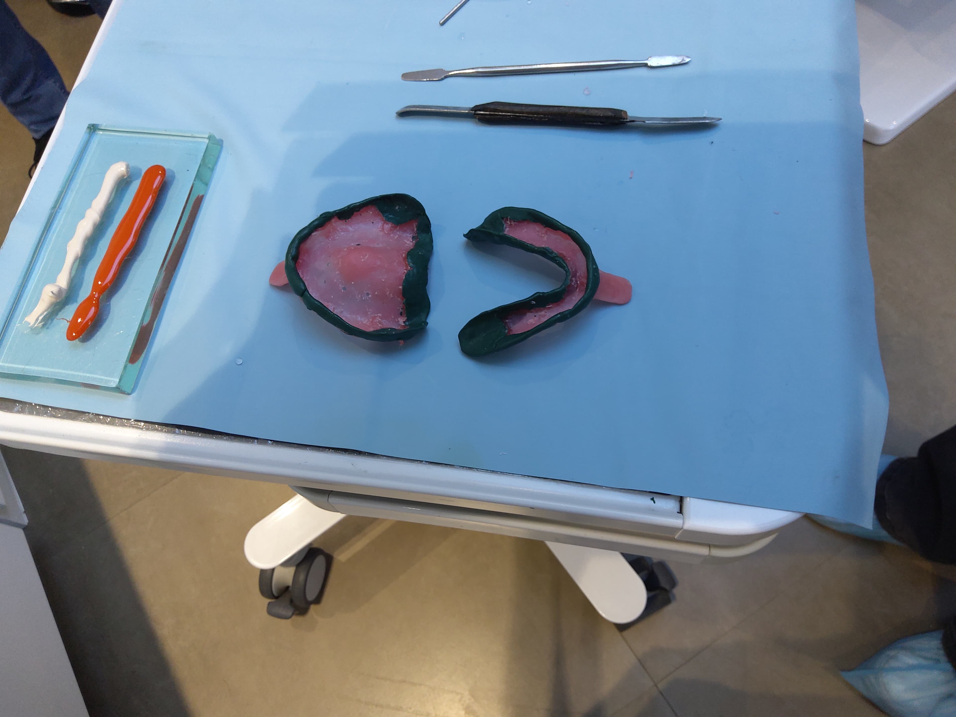 Dentures 4