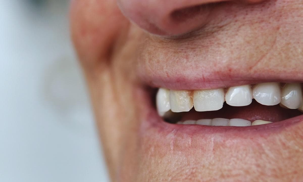 Geriatric Dentistry