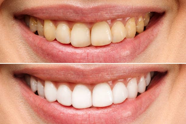 Dental Greens — artistry in smile design 1