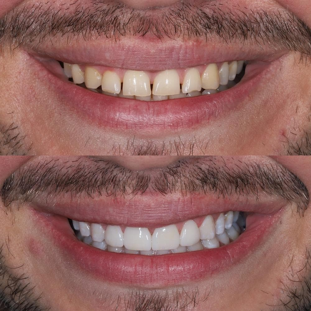 Dental Greens — artistry in smile design 2