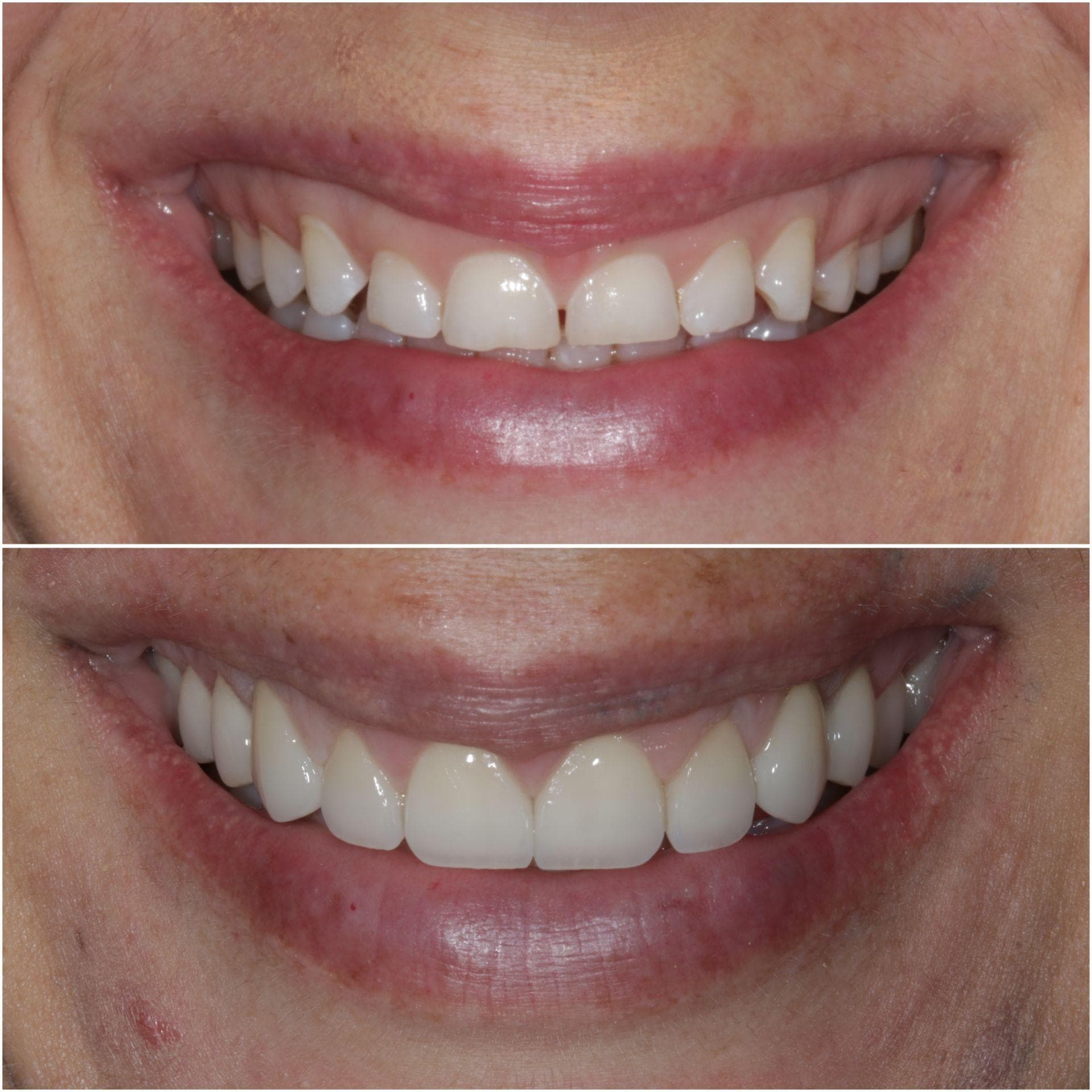 Dental Greens — artistry in smile design 3