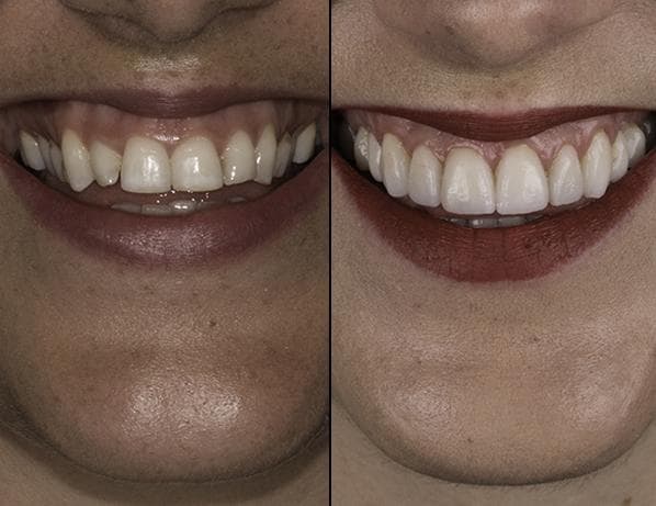 Dental Greens — artistry in smile design 4