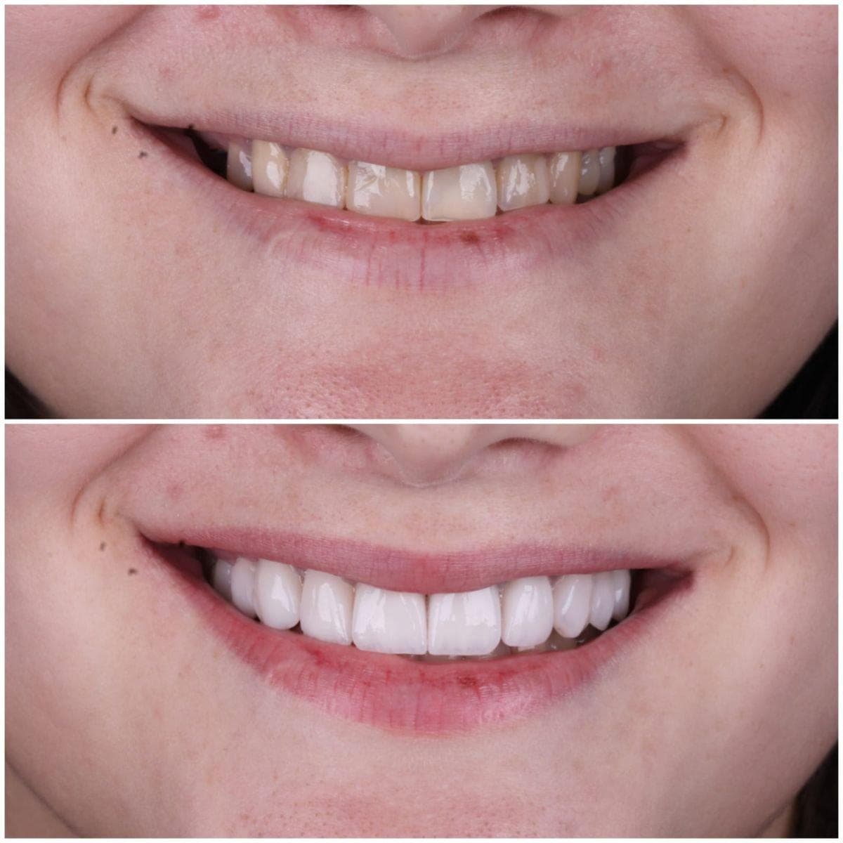 Dental Greens — artistry in smile design 5
