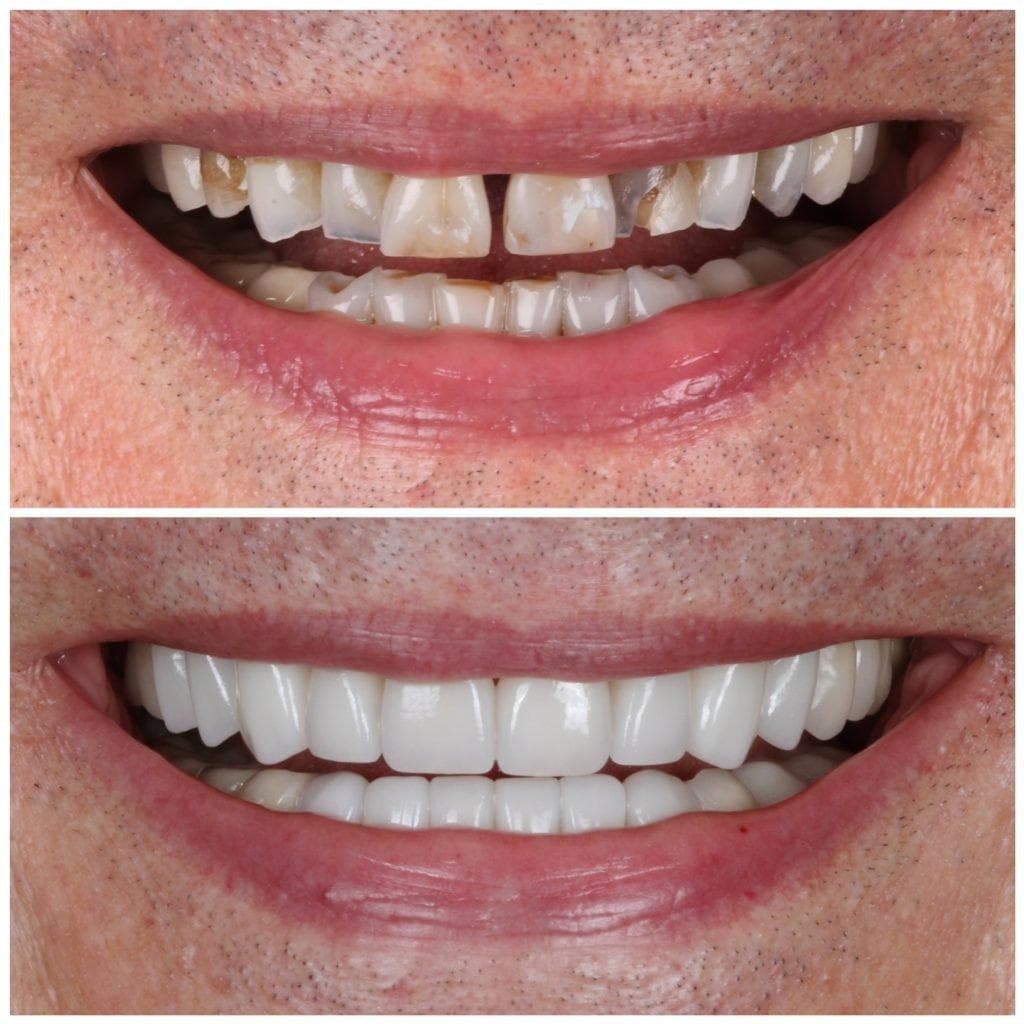 Dental Greens — artistry in smile design 6