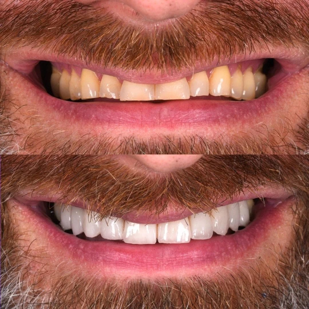 Dental Greens — artistry in smile design 7