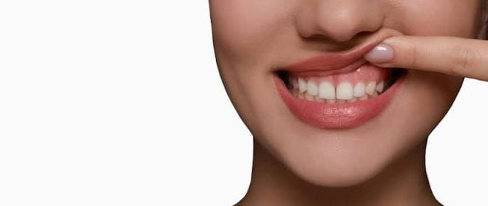 Advanced Gum Treatment