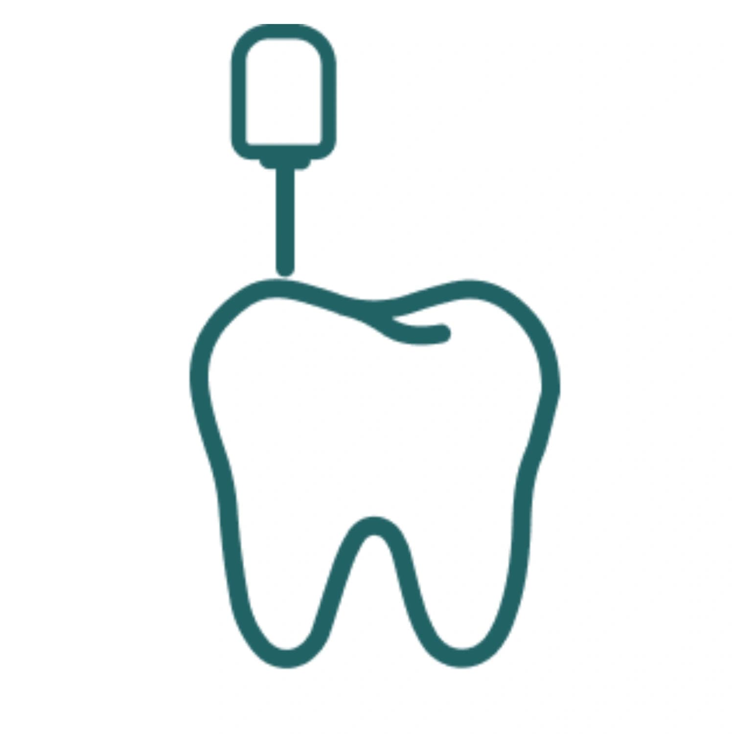Root Canal Treatment