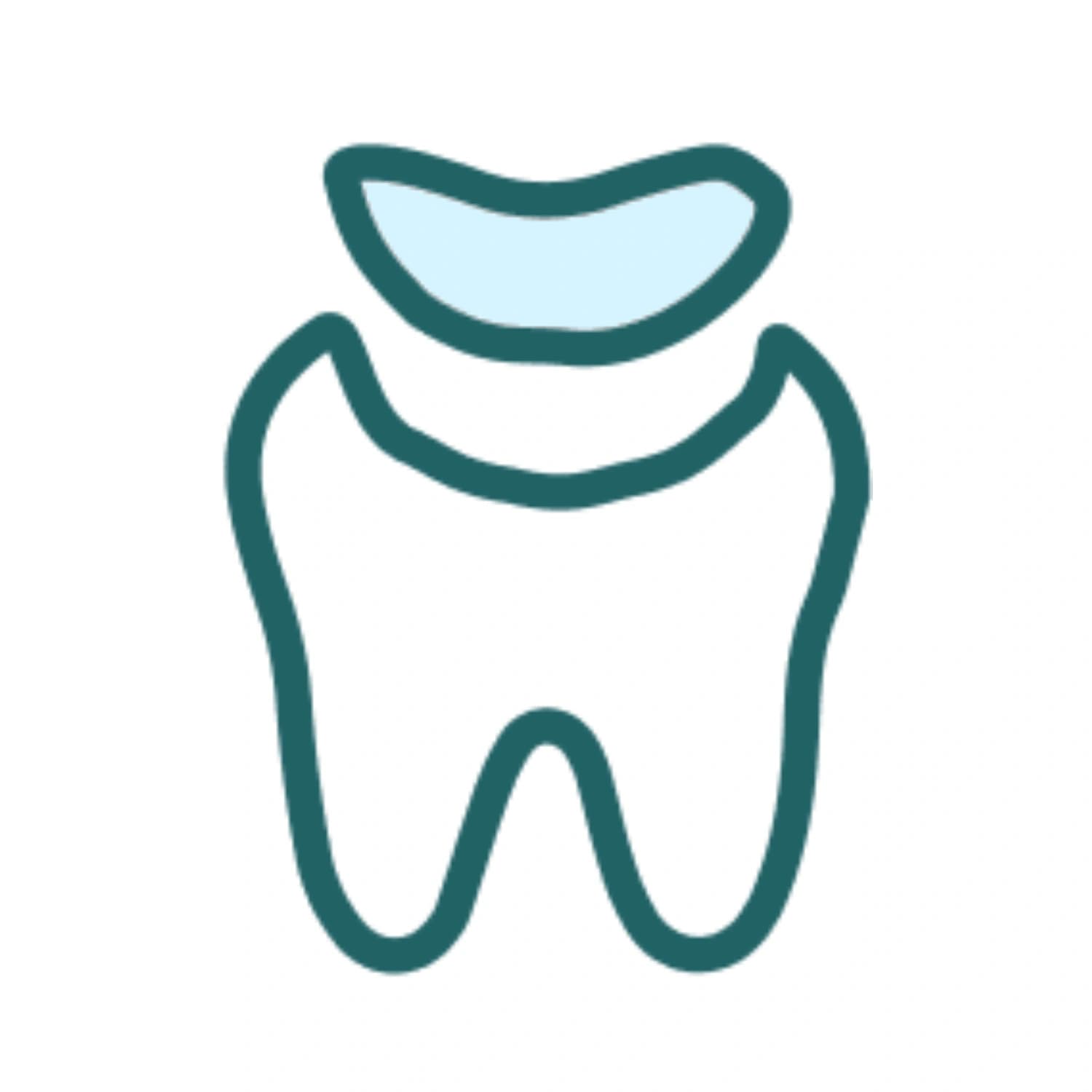 Tooth Colored Fillings